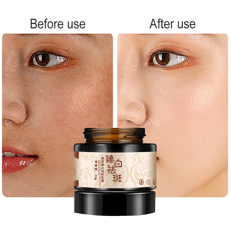 dark face cream