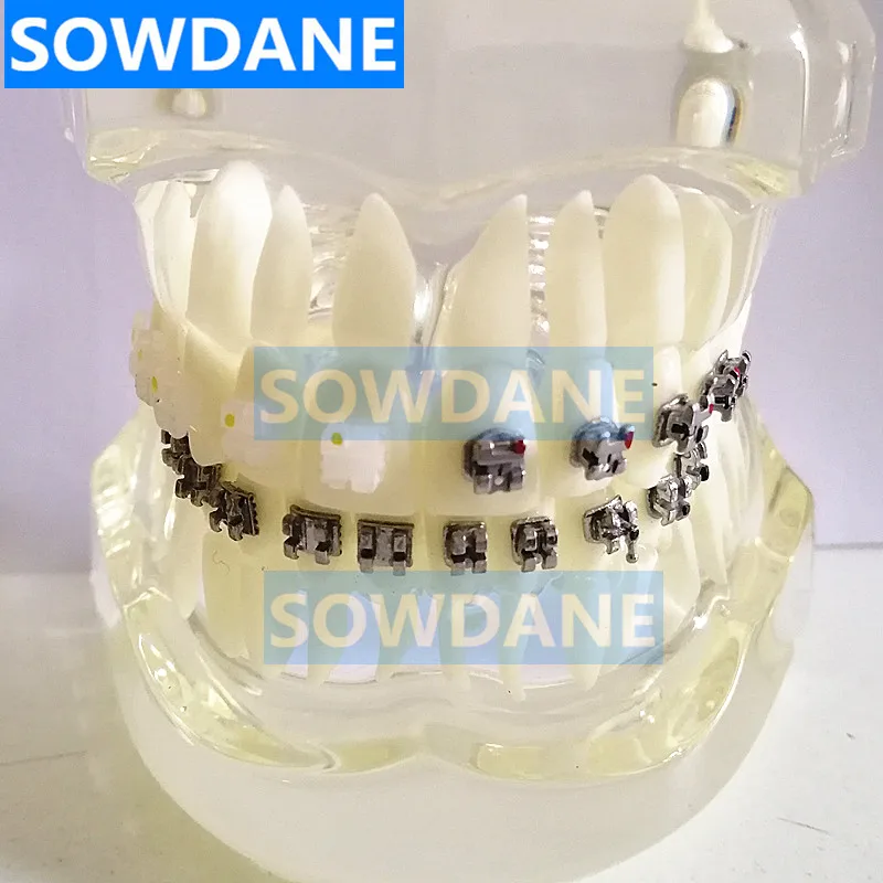 White 4 comparison Прозрачная Стоматологическая Ортодонтическая модель зубов с керамическими и металлическими кронштейнами для связи пациента - Цвет: White 4 comparison