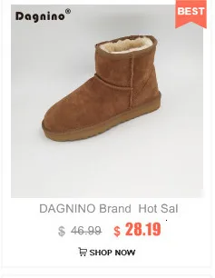 DAGNINO/женские теплые зимние сапоги из натуральной овечьей кожи; женские ботильоны с натуральным мехом и пуговицами высокого качества