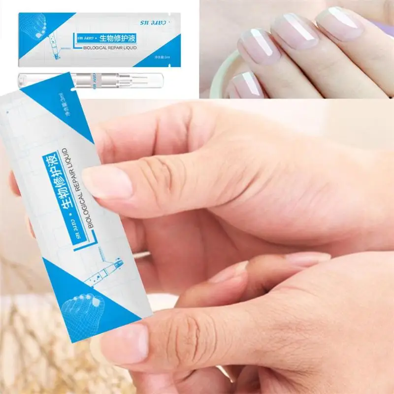 3 мл ручка для ногтей Onychomycosis инфекция пальцы ног портативный высокая проницаемость без стимуляции ногтей здоровье Травяной Уход жидкость