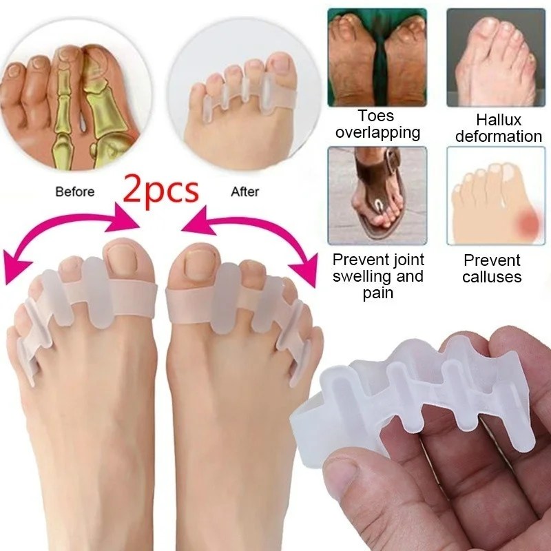 2 шт., средство для ухода за ногами, разделитель пальцев ног, перекрывающий пальцы, реабилитационное лечение вальгусной деформации, подтяжки, ортопедическое устройство для кости стопы