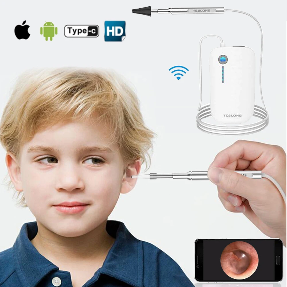 3.9mm WIFI Ear Endoscope Camera For Iphone IP67 3 in 1 Type C Otoscope