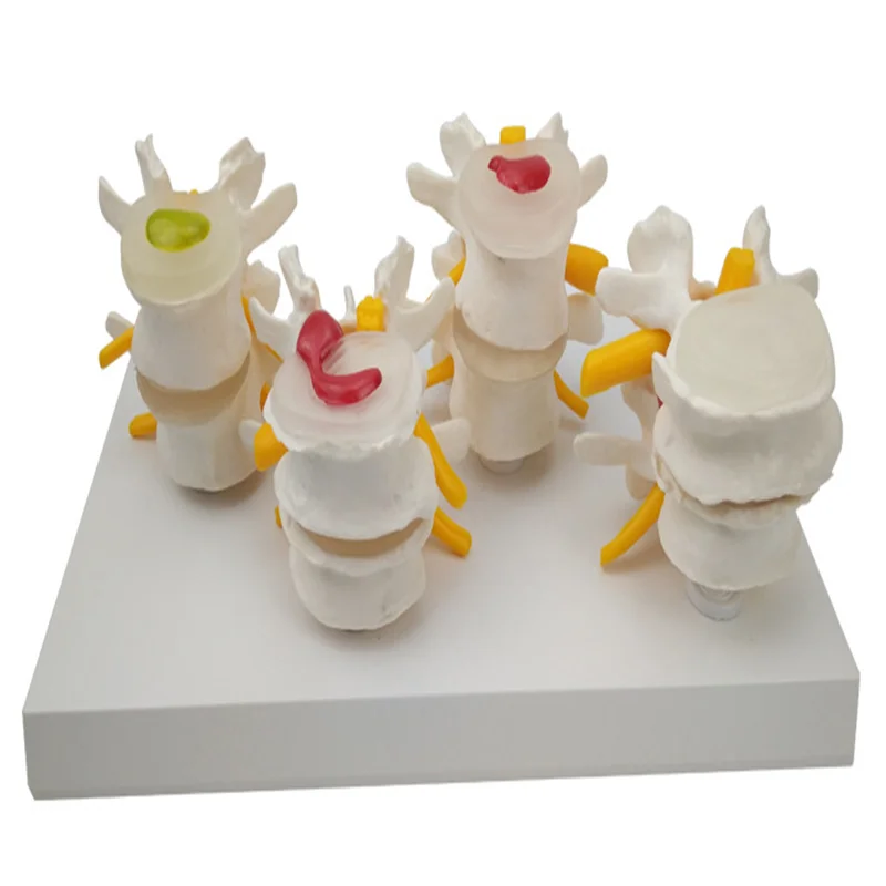 Медицинская модель позвоночника 4 этапа|model anatomy|medical teaching modelanatomy model |