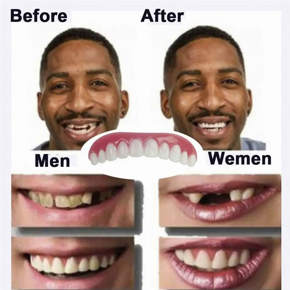 H2017fc52ee4445c7a5c3c9a1cd57fd240 Beauty-Health Instant Smile Veneers Cosmetic Teeth