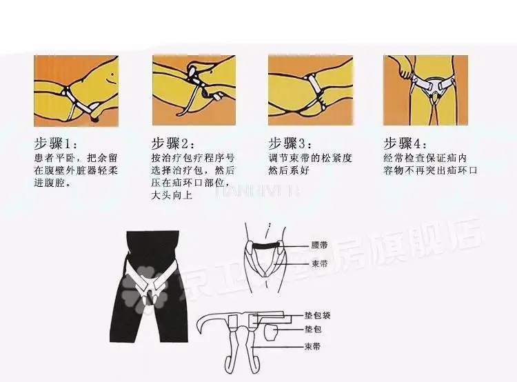 как правильно выбрать размер грыжевого бандажа. грыжевой бандаж для отвислого живота tlm s. бандаж абдоминальный orliman o-104. бандаж противогрыжевой паховый размерная сетка. бандаж для пупочной грыжи (для взрослых) р,2 (01938).