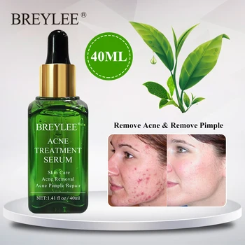 

BREYLEE Acne Treatment Serum Facial Essence 40ml Anti Acne Scar Removal Cream Skin Care Whitening Repair Pimple Remover