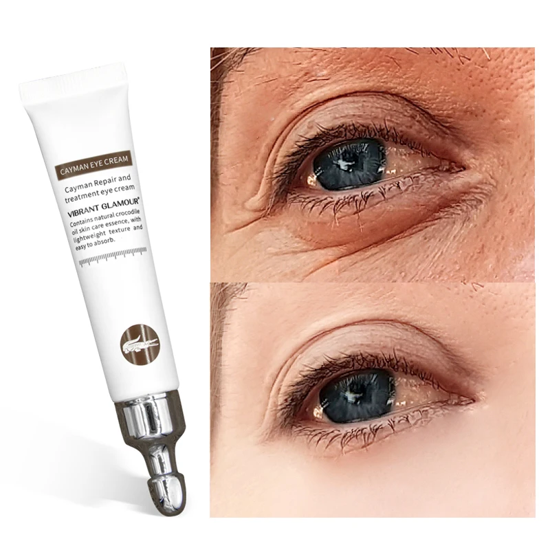 

20g Crocodile Anti-Aging Wrinkles Eye Cream Hyaluronic Acid Gel Whitening Moisturizing Remove Dark Circles Puffiness
