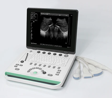 

15 in LED screen notebook ultrasound free shipping