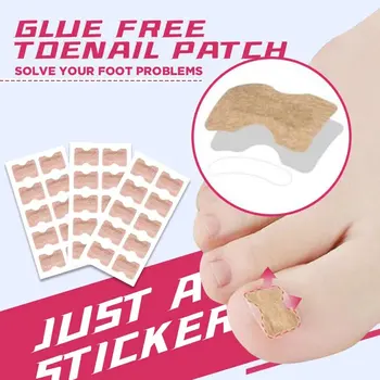 

Nail tape stickers Anti-roll nails glue-free toe inlay nails corrector nail patch pull manicure dedicated sticker