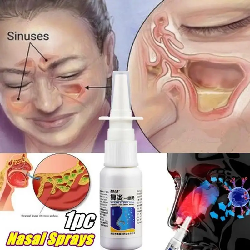 Традиционные медицинские травы спрей для ухода за носом хронический ринит