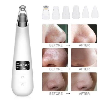 

Massager Blackhead Vibration black point vacuum Cleaner 6 Treatment Heads Face Cleansing Instrument Pores Cleaner Face