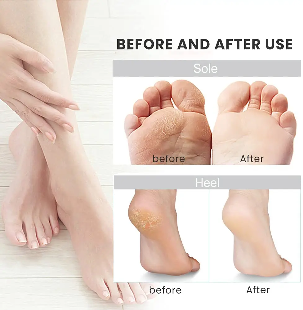Rechargeable Electric Foot File Callus Remover Machine Pedicure Device Foot Care Tools Feet For Heels Remove Dead Skin black 2