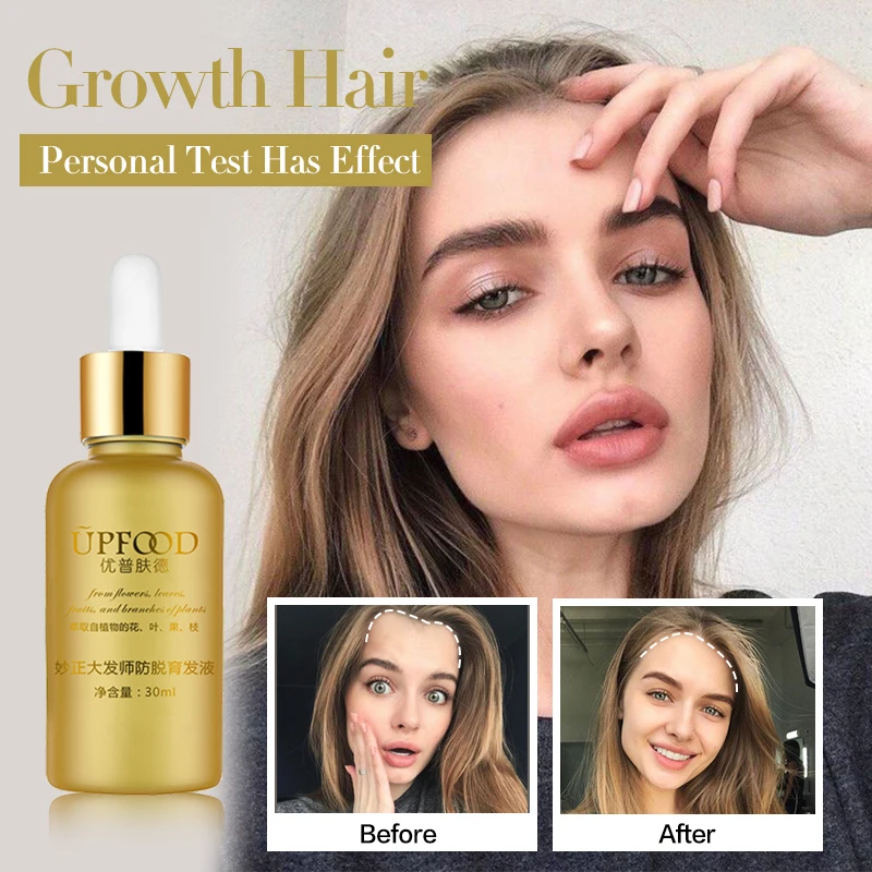 Выпадение волос питающее масло быстрое средство для роста волос масло уход помогает для роста волос толстый рост помощник масло для волос 2 шт