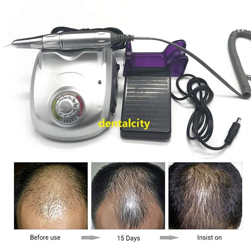Оборудование для трансплантации волос Fue инструмент для трансплантации волос FUE