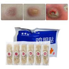 24/42/48 шт, ухаживает за кожей стоп медицинский пластырь для ног "Кукуруза" убийца мозолей подошвенные бородавки шип болеутоляющий пластырь для ног средство для удаления мозолей инструменты