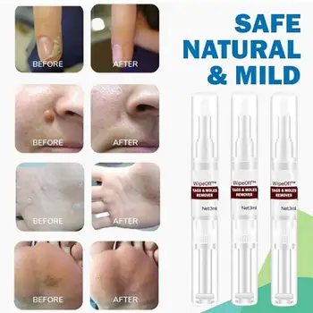 

3ml WipeOff Tags Moles Remover Liquid Wart Removal Pen Genital Wart Treatment Mighty Tag Spots Remover Wart Tag Freckle Skin
