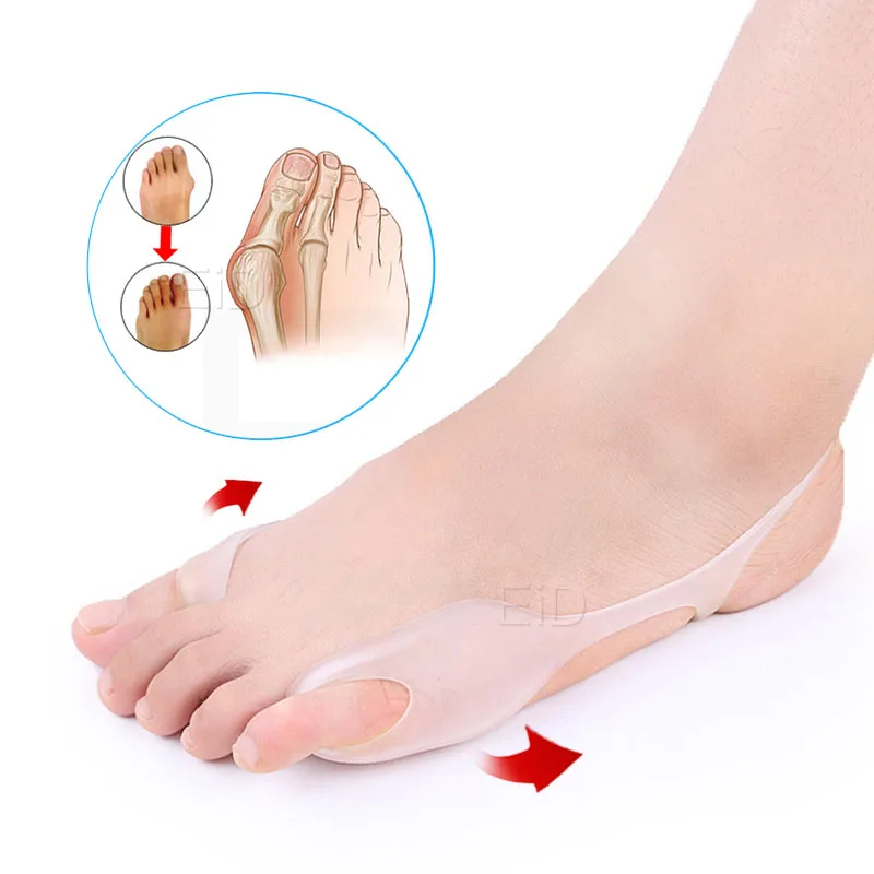 EiD 2 шт Sinlicone Hallux разделитель пальцев при вальгусной деформации силиконовые стельки носок бандаж на палец выравнивание прибор палец болеутоляющее вставка - Цвет: Free size