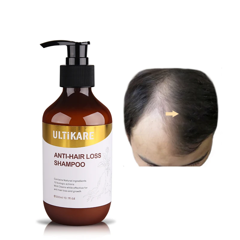 Professional High Grade Anti-hair Loss Chinese Herbal Shampoo Growth promotion Prevent Hair Treatment for Men&Women Professional High Grade Anti-hair Loss Chinese Herbal Shampoo Growth promotion Prevent Hair Treatment for Men&Women