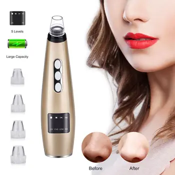 

Vacuum Blackhead Acne Cleaner Pore Remover Electric Skin Facial Cleanser Care