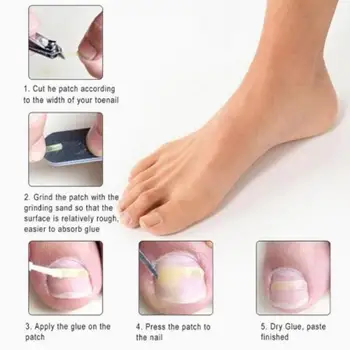 

Toenail Ingrown Correction Tool Set Toe Nail Lifter Pedicure Nail Glue Pusher Foot Nail Straightening Toenail Care Recover C8E4