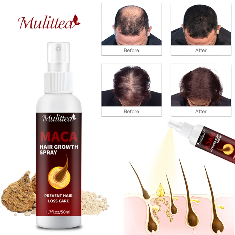 Mulittea Maca Extract Hair Growth Spray Serum Products Prevent Dry