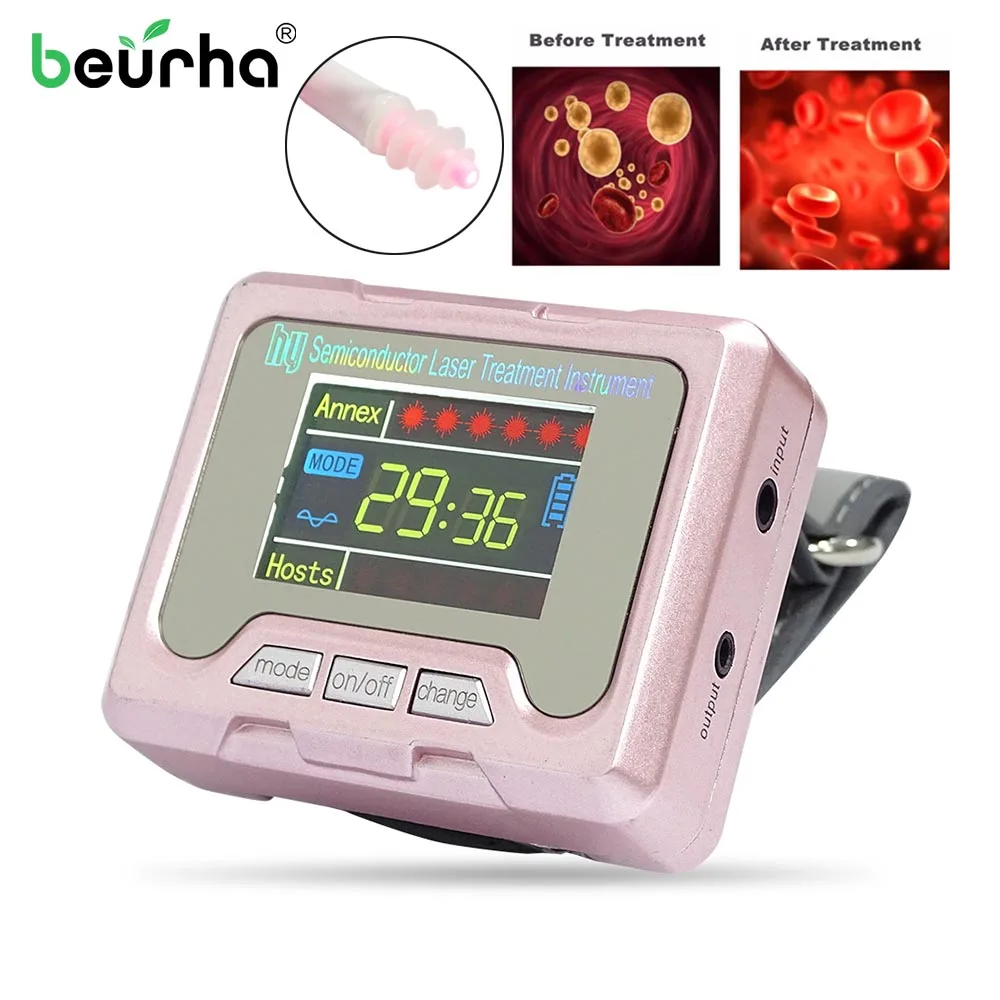 

Household 650nm Laser Physiotherapy Wrist Diode LLLT for Diabetes Hypertension Treatment Diabetic Watch Laser Sinusitis Therapy