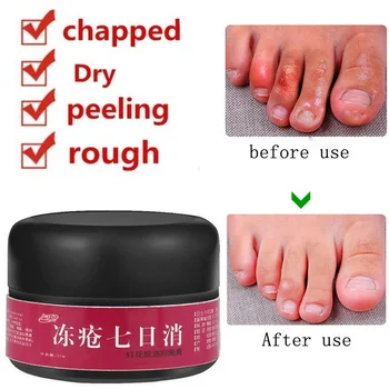 

Foot Crack Cream Heel Chapped Peeling Foot Hand Repair Anti Dry Crack Ointment Cream