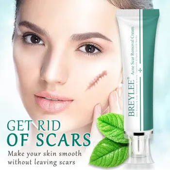 

Scar Repairing Cream Remove Scars Pimple Marks Stretch Marks Skin Care Essential Cream Easy To Absorb
