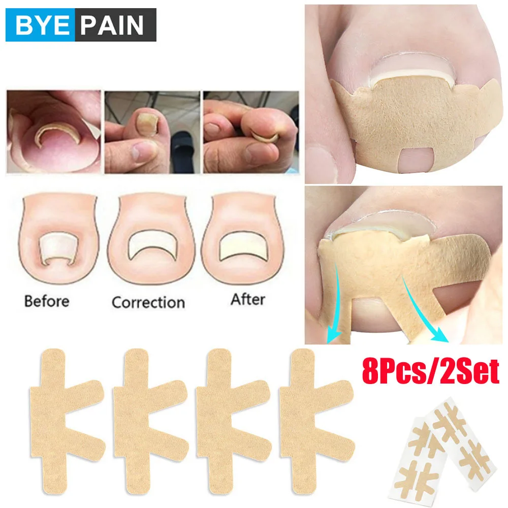 8Pcs/2Set Embedded Toe Nail Corrector Sticker Toenail Care Pedicure Thumb Curl Correction Sticker Paronychia Recover sharkbang new bobo 8pcs full set kpop stickers agenda kawaii decorative korean sticker journal stationery suppliers