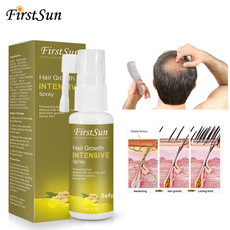 

4Pcs 30ML Fast Hair Growth Intensive Spray Treatment Oil For Anti Hair Loss Ginseng Ginger Extract Stimulate Hair Regrowth Dense