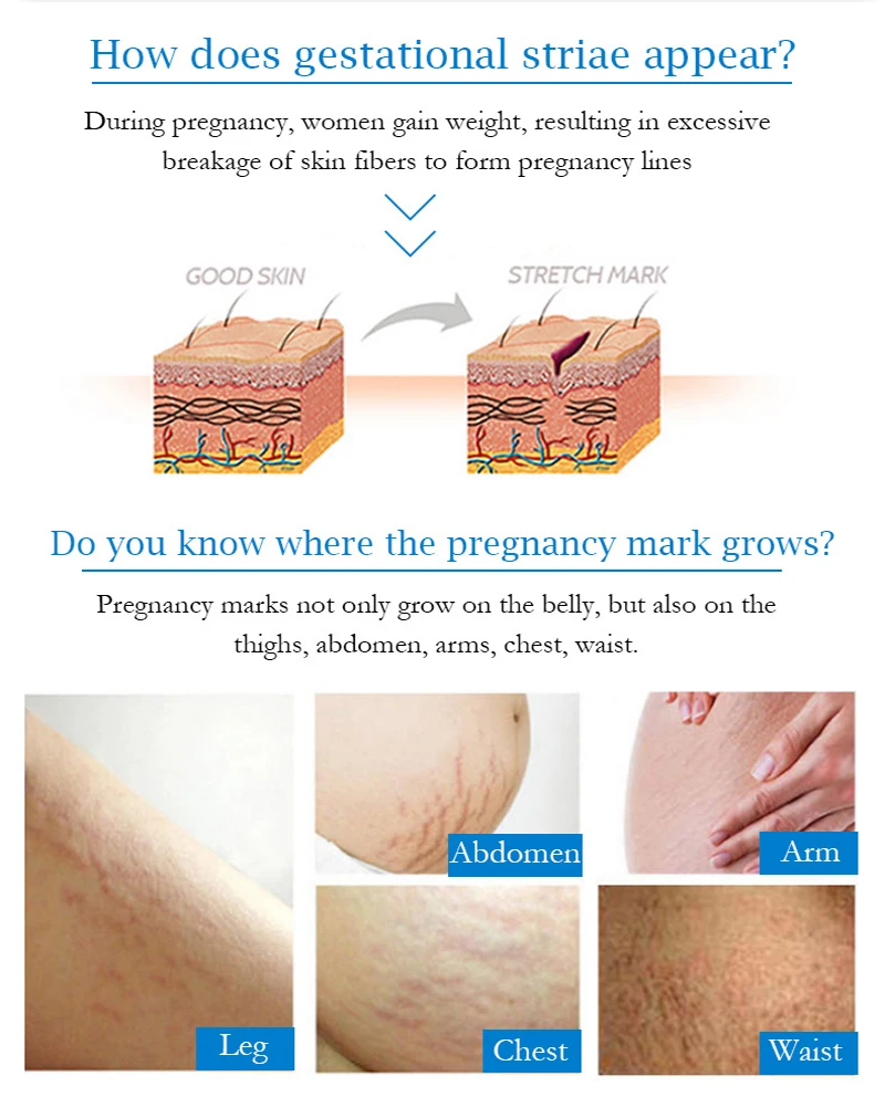 12753347673_844614343