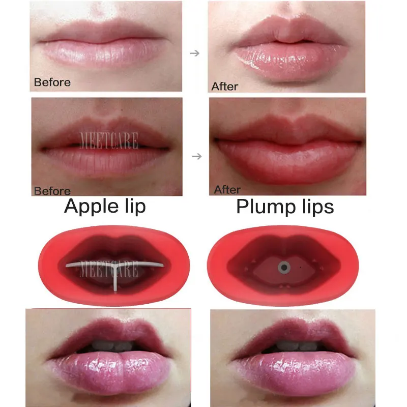 Женские силиконовые устройства для пухлости для губ автоматический плампер для увеличения губ быстрое естественное сексуальное увеличивающее устройство для губ