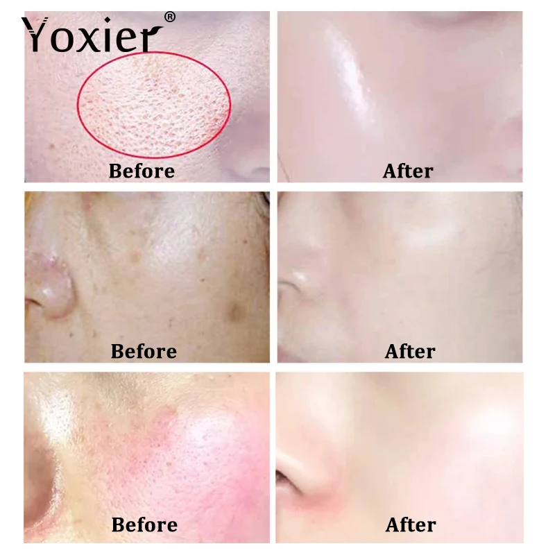 Yoxier 3 шт./лот питательный крем с пионами и улиткой антивозрастной для лица