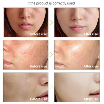 

Vitamin C Whitening Essence Hyaluronic Acid Moisturizing Anti-Aging Skin Care EY669