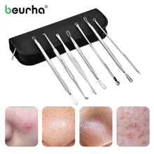 Средство для удаления черных точек, вакуумный экстрактор акне и комедона, средство для удаления черных точек, средство для удаления акне, очищение лица