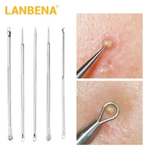 LANBENA 5 шт. из нержавеющей стали, пятнистая белая головка, черная головка, подходит для удаления акне, экстрактор для удаления угрей, иглы, набор для прыщей, инструмент для макияжа