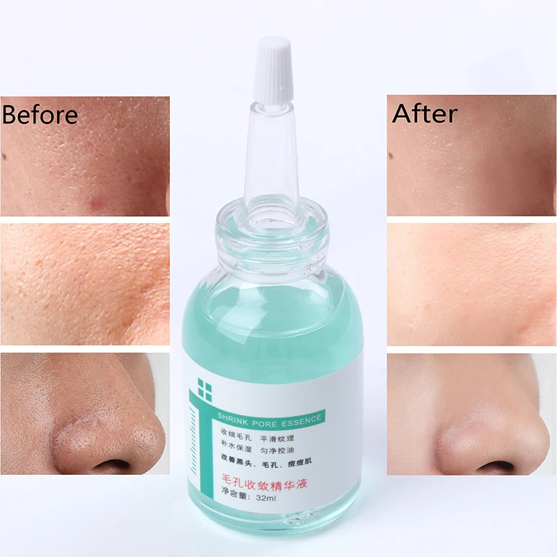 Pore Contraction Refining Essence Face Serum Improve Firming Facial Repair Anti Wrinkle Aging Moisturize Skin Care 32ml | Красота и