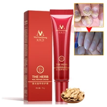 Ремонт ногтей травяной крем для ногтей грибок ногтей Лечение Onychomycosis Paronychia Anti Fun