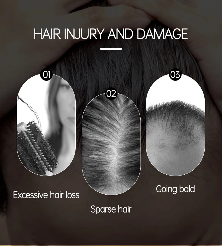 Hairinque Vitamin B7 Hair Growth Oil Prevent Hair Loss Serum Scalp