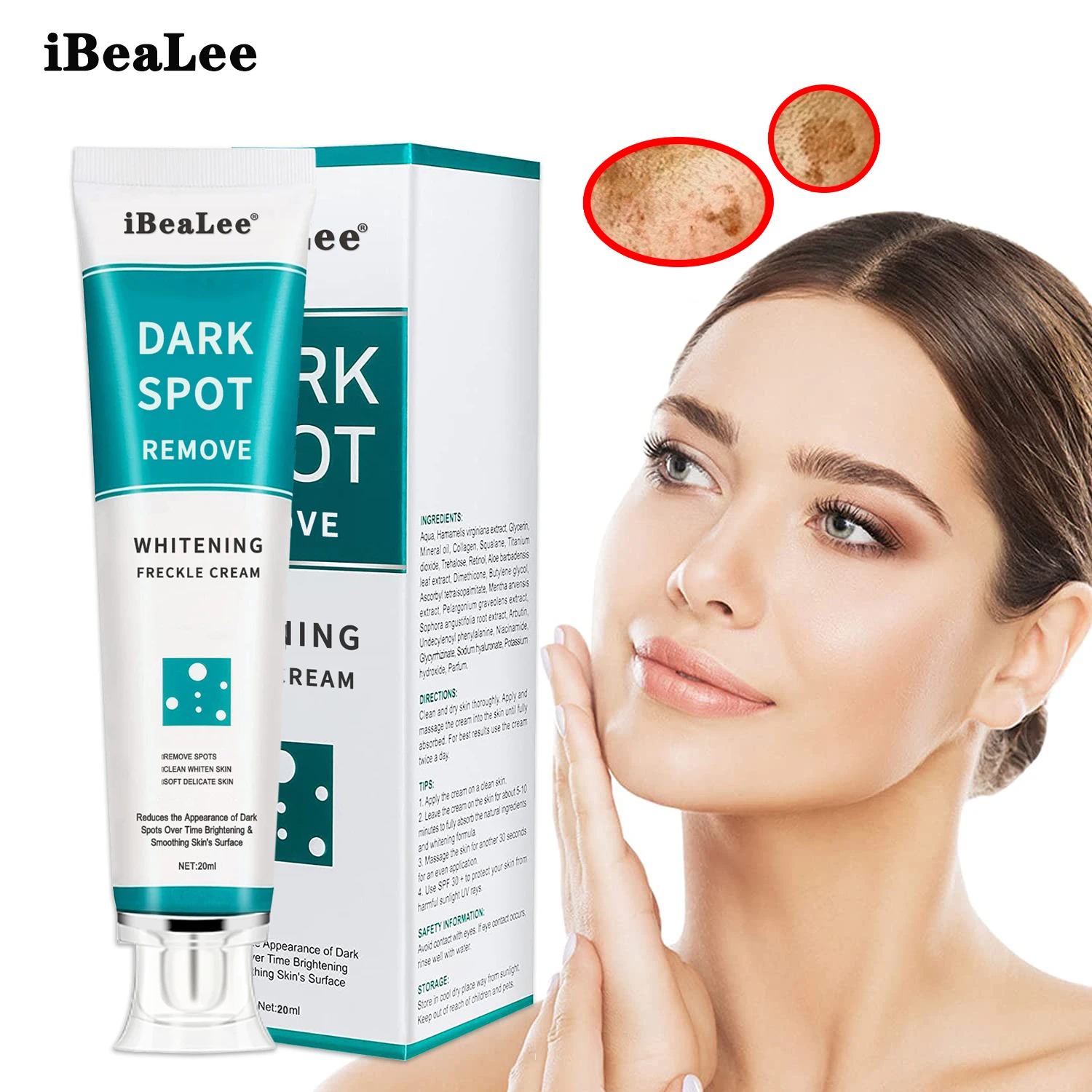 Effective Whitening Freckle Cream Remove Melasma Acne Spot Pigment Melanin Dark Spots Pigmentation Moisturizing Gel Skin Care | Красота и