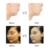 Подтяжка Лица Silk Fbroin Line Carving Essence Absorbable Radar Thread No Needle Collagen Facial Lift Hyaluronic Tightening Care
