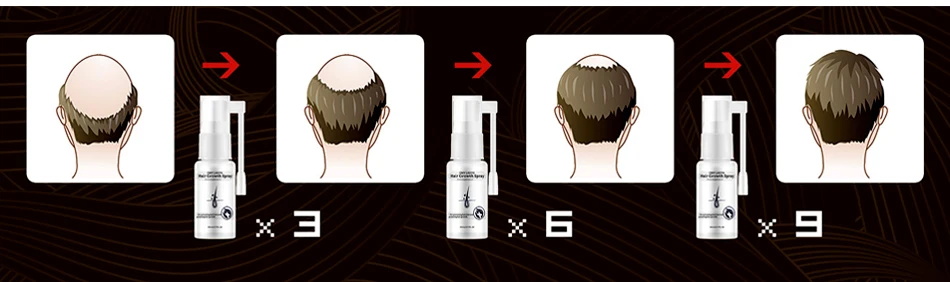 Queda de Cabelo Spray de Óleo Líquido para Homens Reparação de Regeneração do Cabelo Produtos de Cuidados com o Cabelo Senhora Anti Crescimento Essencial Mulheres Seco Omy 5 Prod. perda cab. masc.