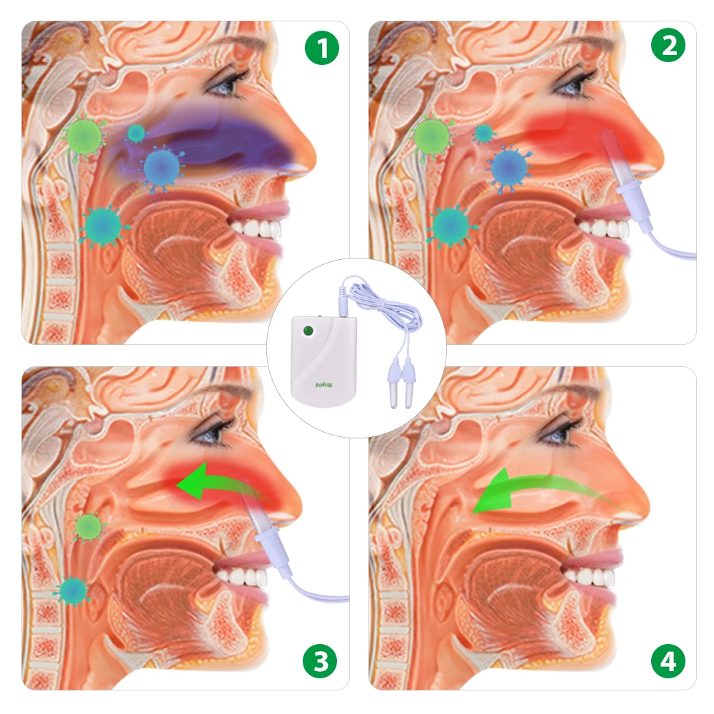 Laser Nose Massager Bionase Nose Rhinitis Sinusitis Cure Infrared Therapy Low Frequency Nasal Health Care Machine Instrument