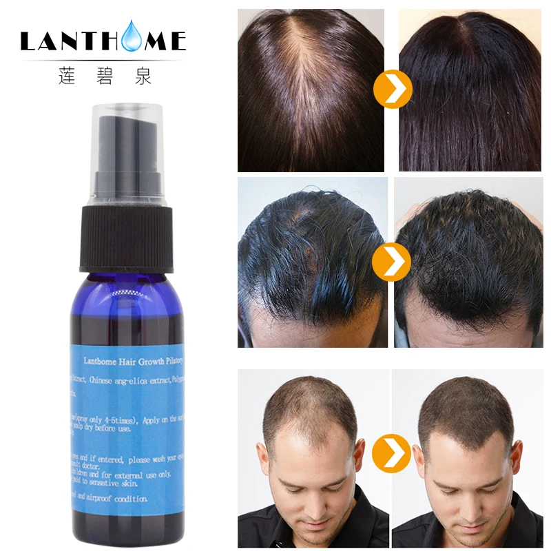 Спрей для роста волос с экстрактом облысения 30 мл|beard growth|beard growth oilhair loss spray |