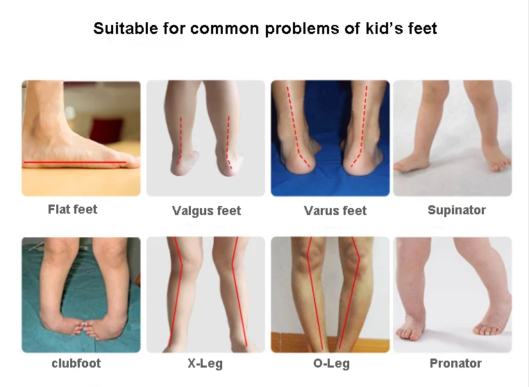 Sandálias ortopédicas infantis de verão, Criança, Calçado