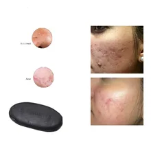 Отбеливающий крем, водная эмульсия, мыло, базовое очищающее прополисное мыло, увлажняющее против веснушек, бамбуковое угольное турмалиновое мыло