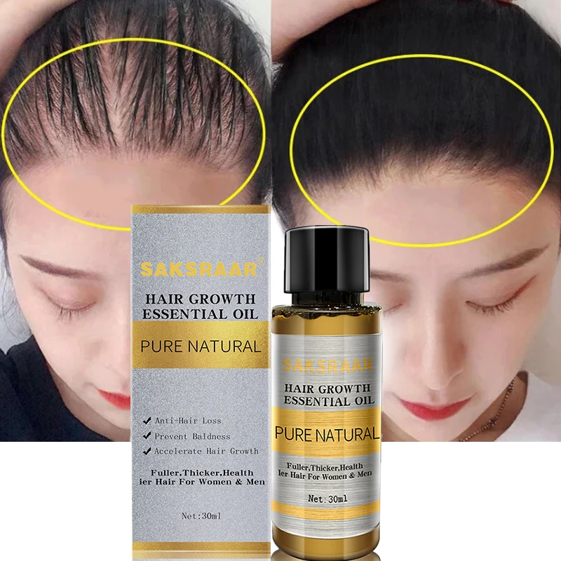 Hair Care Hair Growth Essential Oils Essence Original Authentic 100% Hair Loss Liquid Health Care Beauty Dense Hair Growth Serum vans authentic convert vr3 vn0009pwhf0 growth garden sunflower