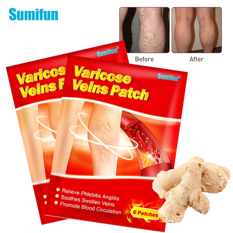 Pain Relief Patch Flower Patch Stickers 12pcs Sumifun Varicose Veins Patch Vasculitis Phlebitis Spider Leg Removal Sticker Varicosity Angiitis Herbal Medical Plaster