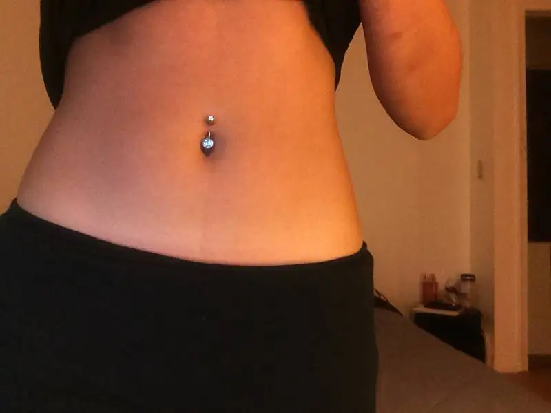 Infected-Belly-Button-Piercing