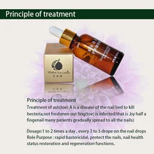 Nail Treatment Essence Fungus Onychomycosis Removal Treatment Toe Repair Essence Liquid V9-Drop